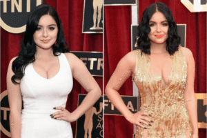 Breast Reduction Surgery Cost in USA